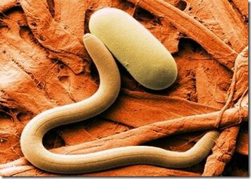 Parasite Types